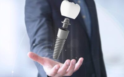 Híd vagy implantátum? 2.