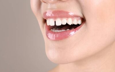 Eltüntethető-e a fogak közötti rés?