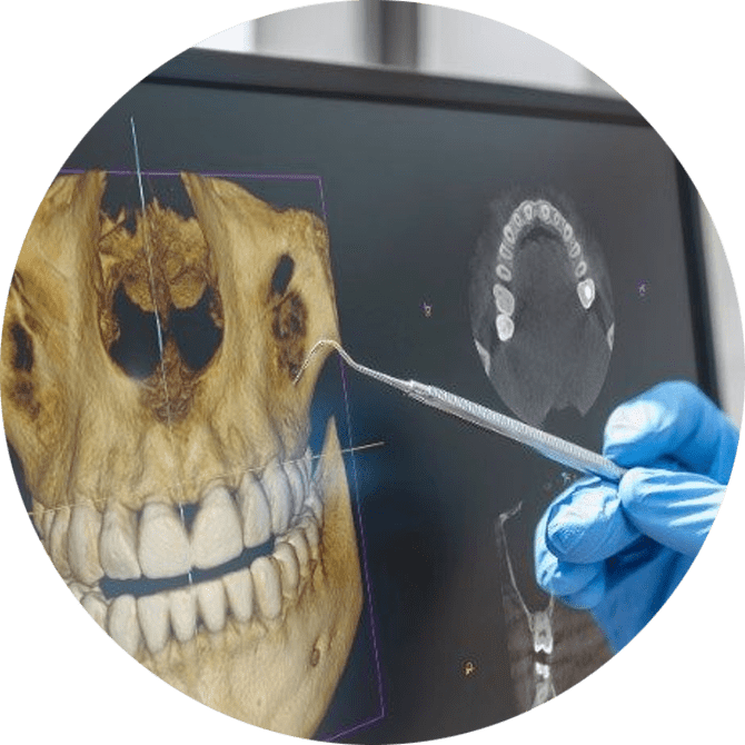 3d-cbct-2
