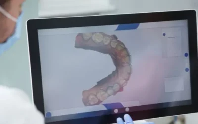 Oral szkenner: a digitális lenyomat új szintje a fogászatban
