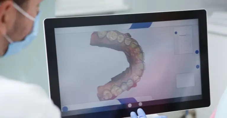 Oral szkenner: a digitális lenyomat új szintje a fogászatban
